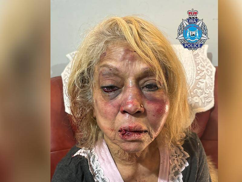 Ninette Simons was left with severe facial injuries following an alleged home invasion. (HANDOUT/WESTERN AUSTRALIA POLICE)